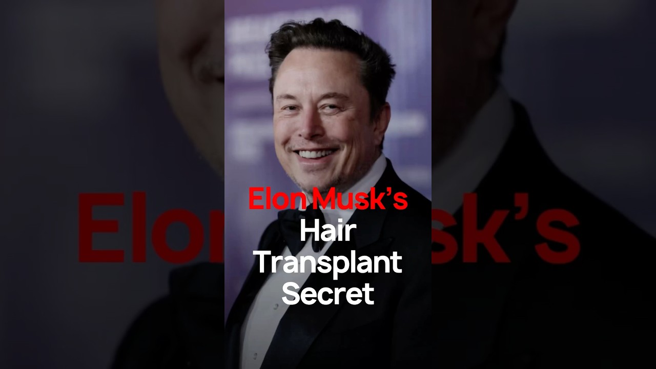 Elon Musk Hair Transplant Explained | Why His Results Lasted for 20+ Years | Elon Musk’s Transplant