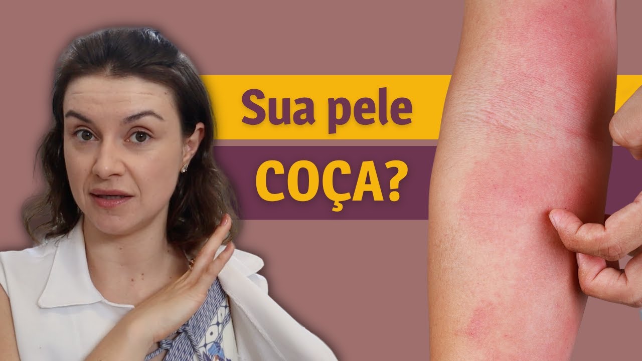 5 dicas de como cuidar de uma pele com DERMATITE ATÓPICA