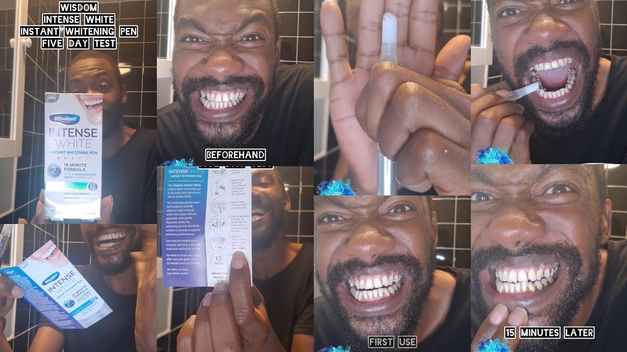 Wisdom Intense White Instant Whitening Pen Five Day Test
