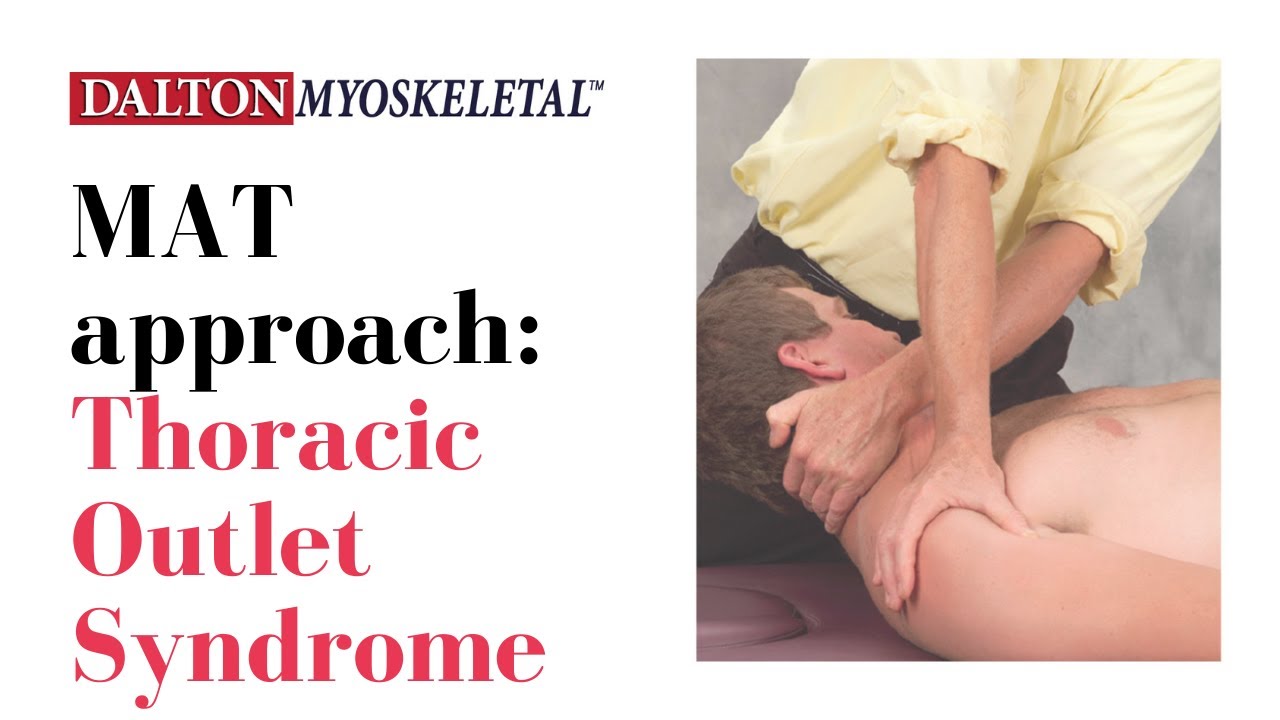 Massage Therapists: Master These Techniques for Thoracic Outlet Syndrome