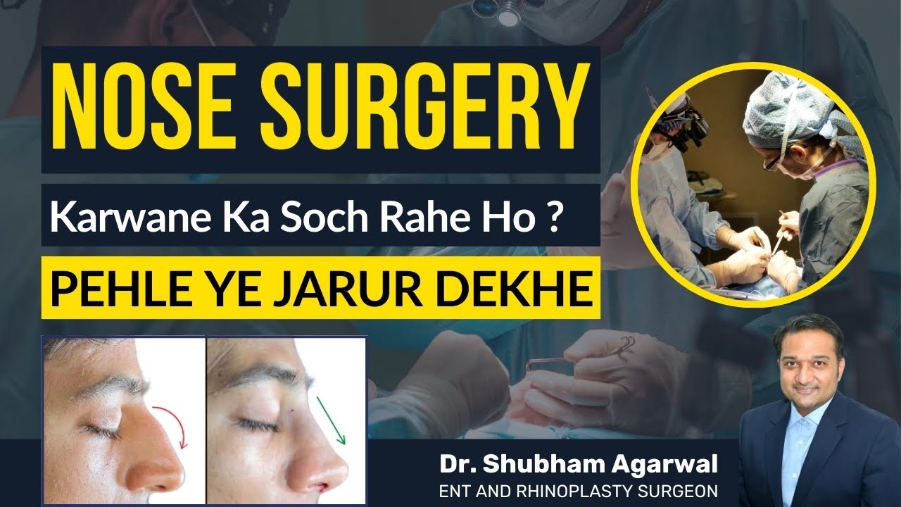 FAQs about NOSE SURGERY! | Dr. Shubham | Rhinoplasty | ENT specialist