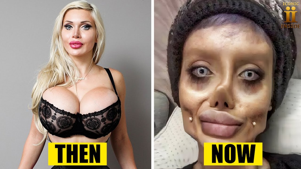 RICH People Who Turned Themselves into PLASTIC!