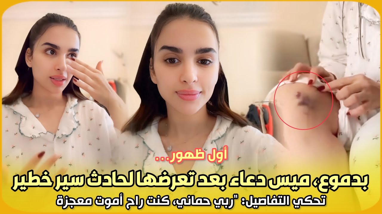 أول ظهور… بدموع، ميس دعاء بعد تعرضها لحادث سير خطير تحكي التفاصيل: “ربي حماني، كنت راح أموت معجزة