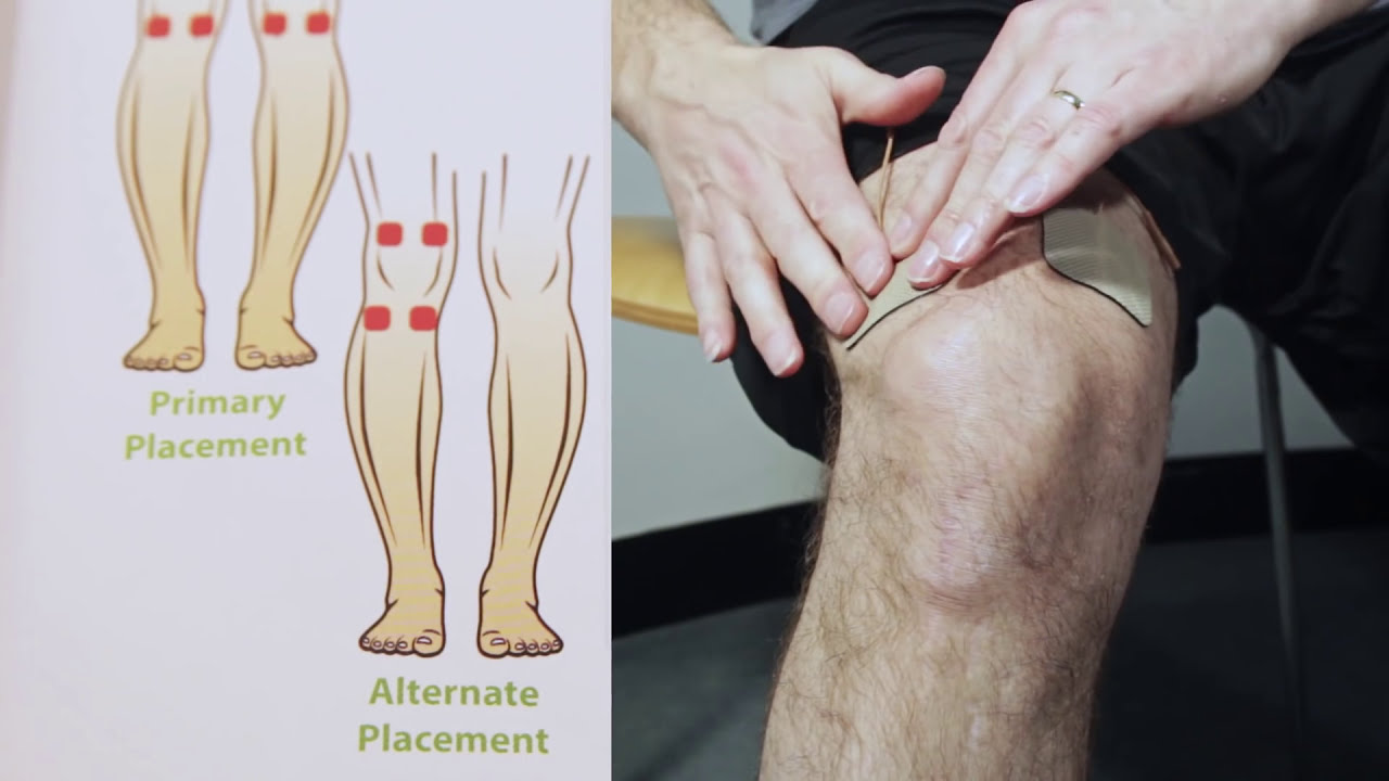 A Guide to use a Tens Machine & Electrode Placement for Tens Devices