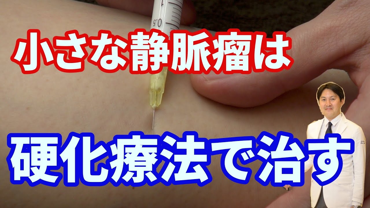 Варикозное расширение вен нижних конечностей — как лечить с помощью склеротерапии