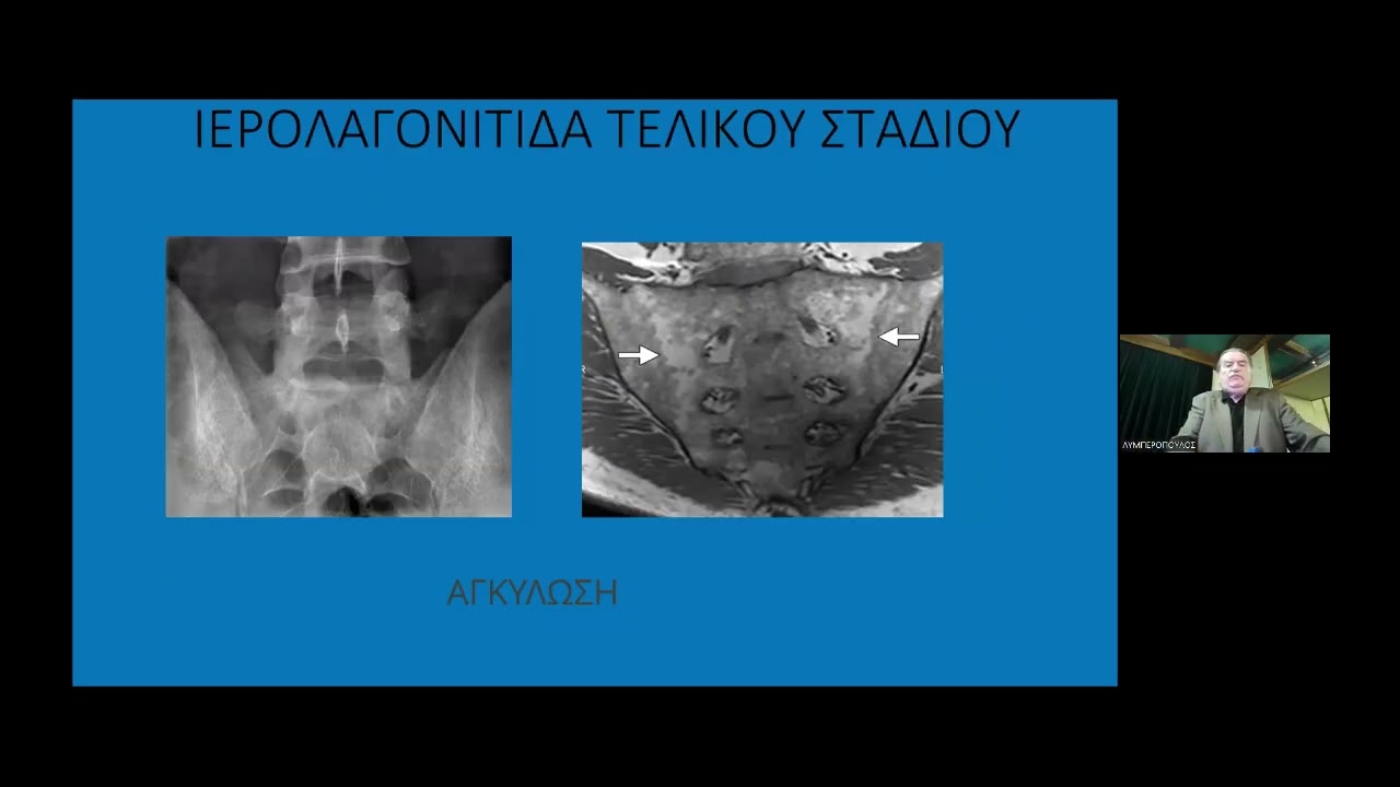 ΛΥΜΠΕΡΟΠΟΥΛΟΣ Κ