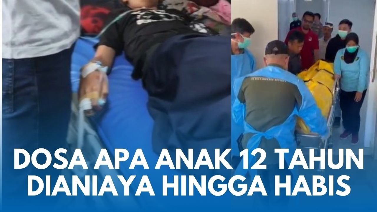 VIRAL TRAGIS Bocah Laki-laki Tak Selamat dengan Tubuh Luka Bakar Karena Ibu Tiri di Sukabumi
