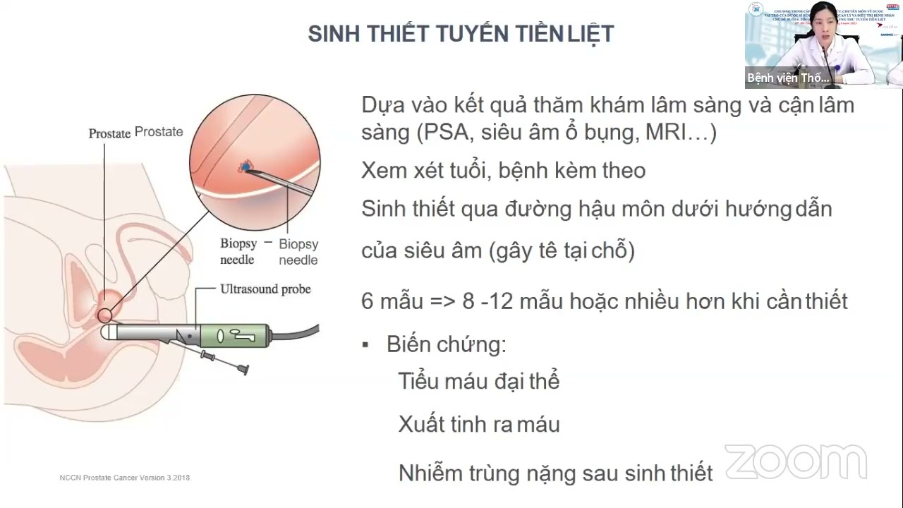 Tổng quan về điều trị ung thư tuyến tiền liệt | BS CKI. Phạm Thanh Hằng