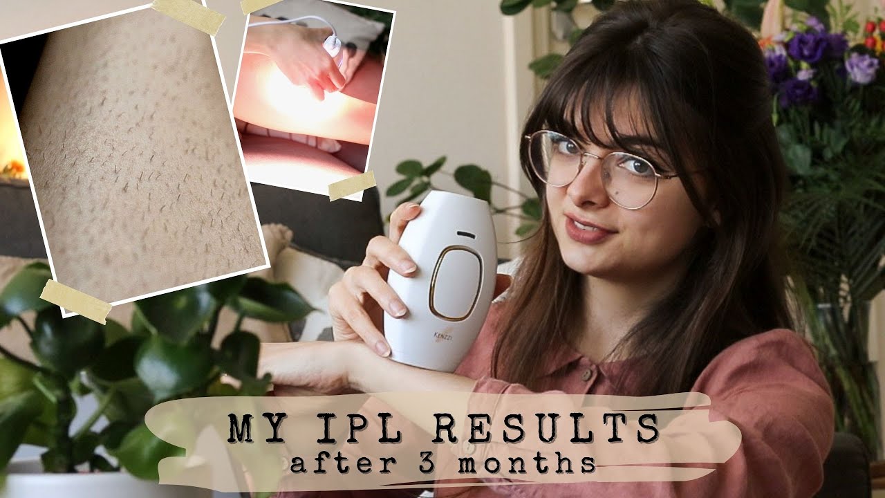 I Used IPL On Only One Side For 3 Months 🦵 Close-Up Results