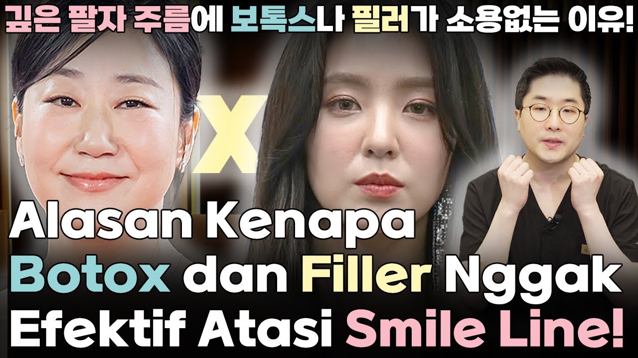 Masih Jaman Atasi Smile Line Pake Filler?! Di Korea, Pakai Ini! Dijamin Gacor!