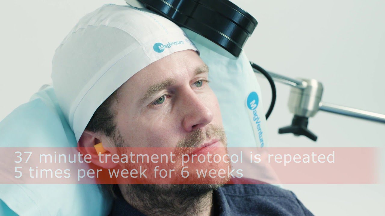 How to treat depression with MagVenture TMS Therapy. No per use fees. High patient throughput