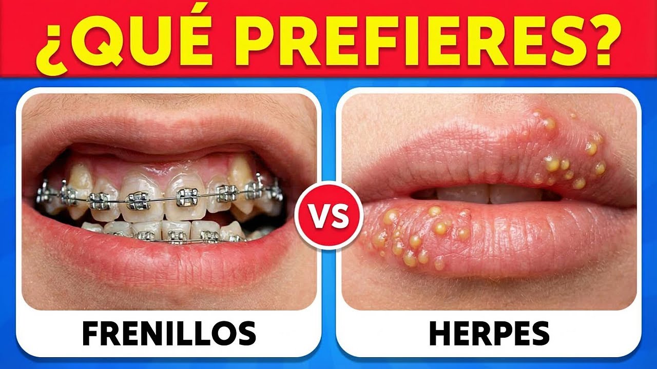 🔥 ¿QUÉ PREFIERES...? 😨 ¡Las 100 Decisiones Más Extremas Que Vas a Tener Que Tomar!