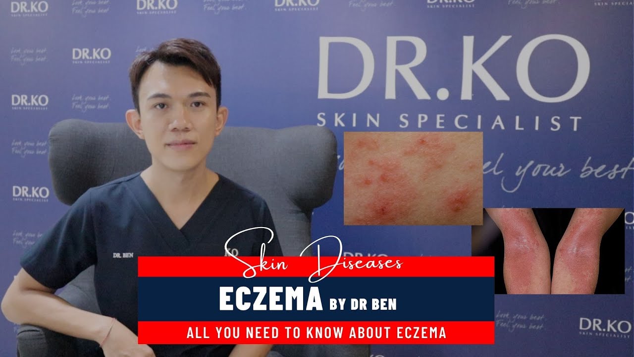 Eczema by Dr Ko Skin Specialist