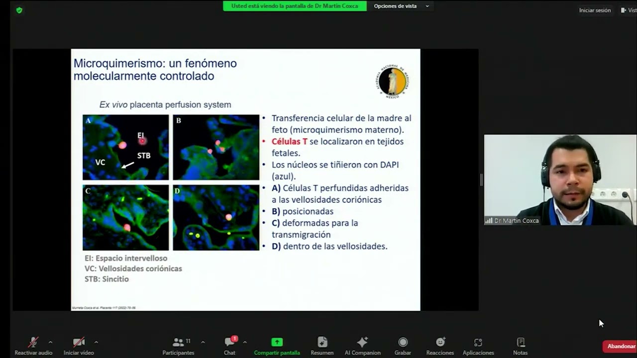 2. La placenta accreta y el microquimerismo. Dr. Martín Murrieta Coxca