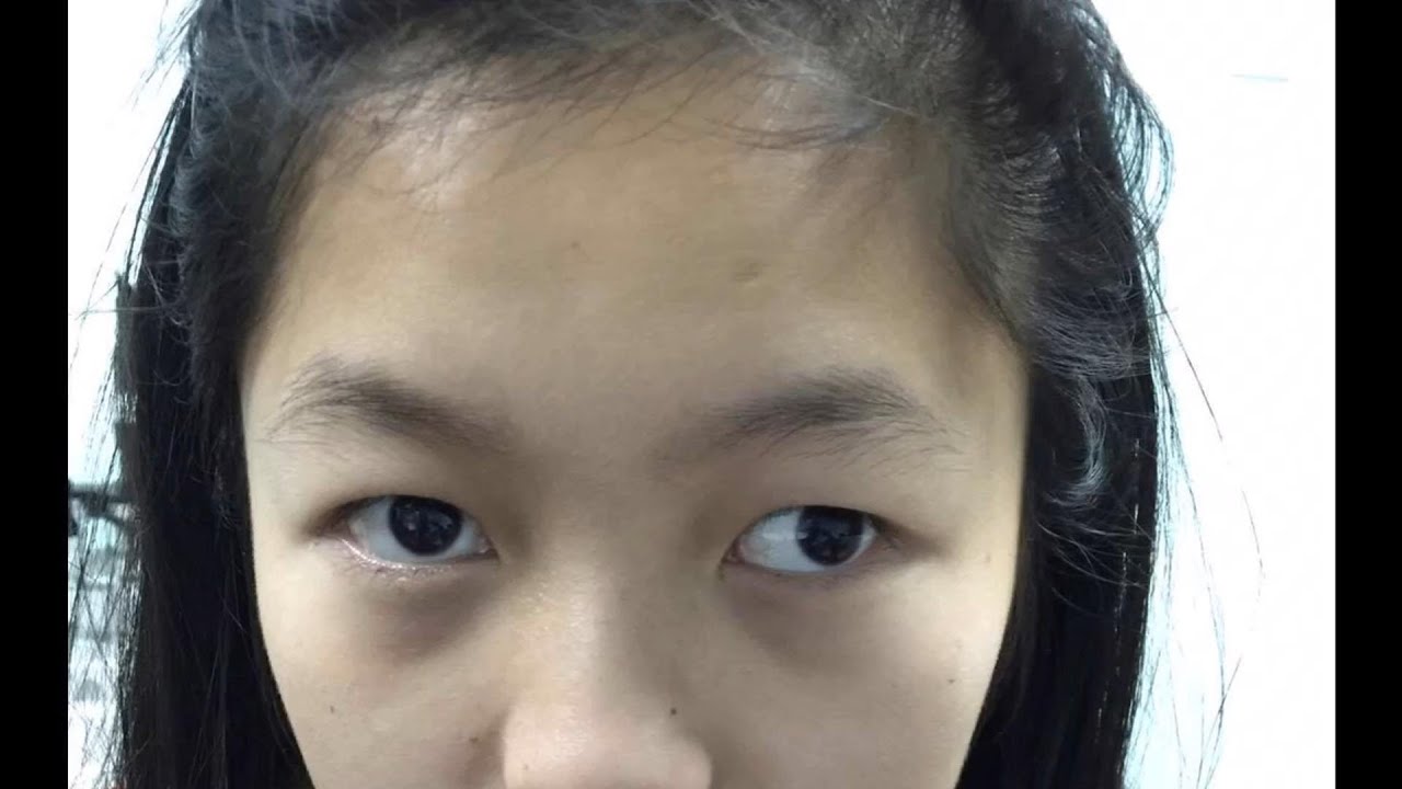六种“阴险小人”面相，心术不正，眼里只有利益，不能深交！