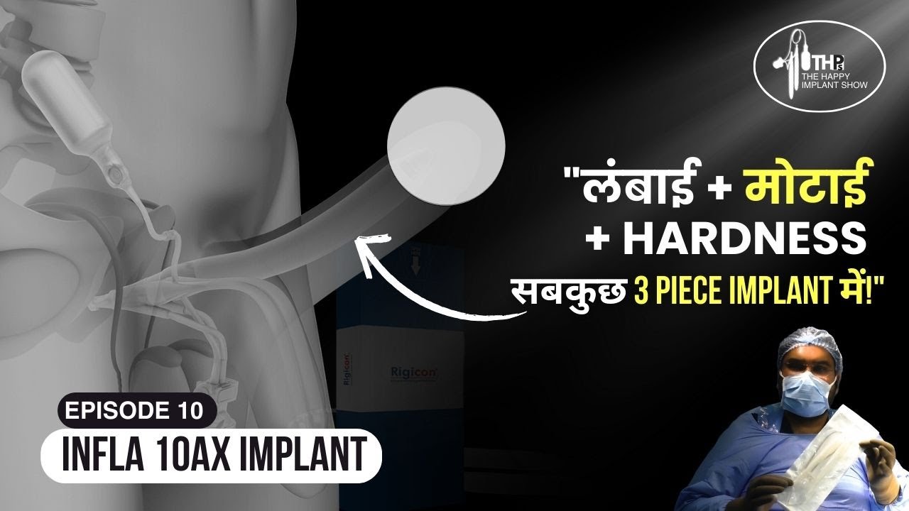 3 Piece Hydraulic Penile Implant [Ep 10] | बटन वाला प्रत्यारोपण