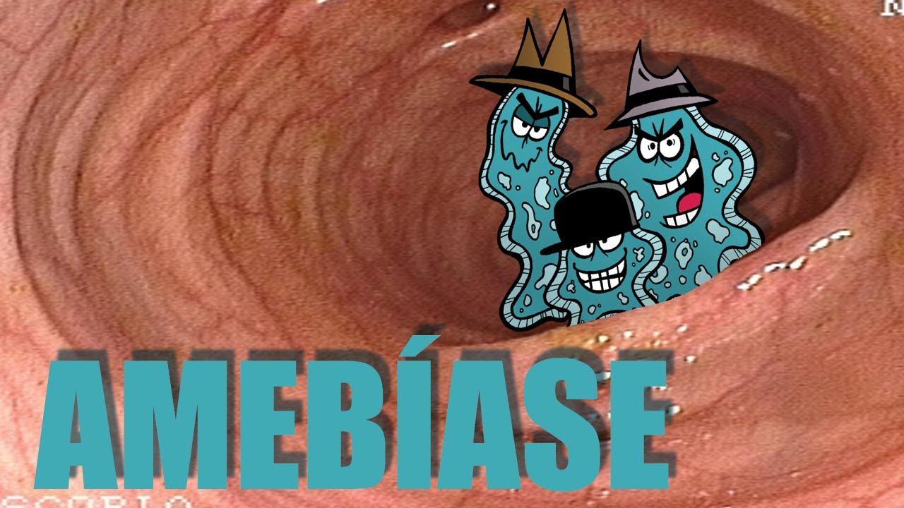 AMEB&Iacute;ASE (TUDO O QUE VOC&Ecirc; PRECISA SABER!)