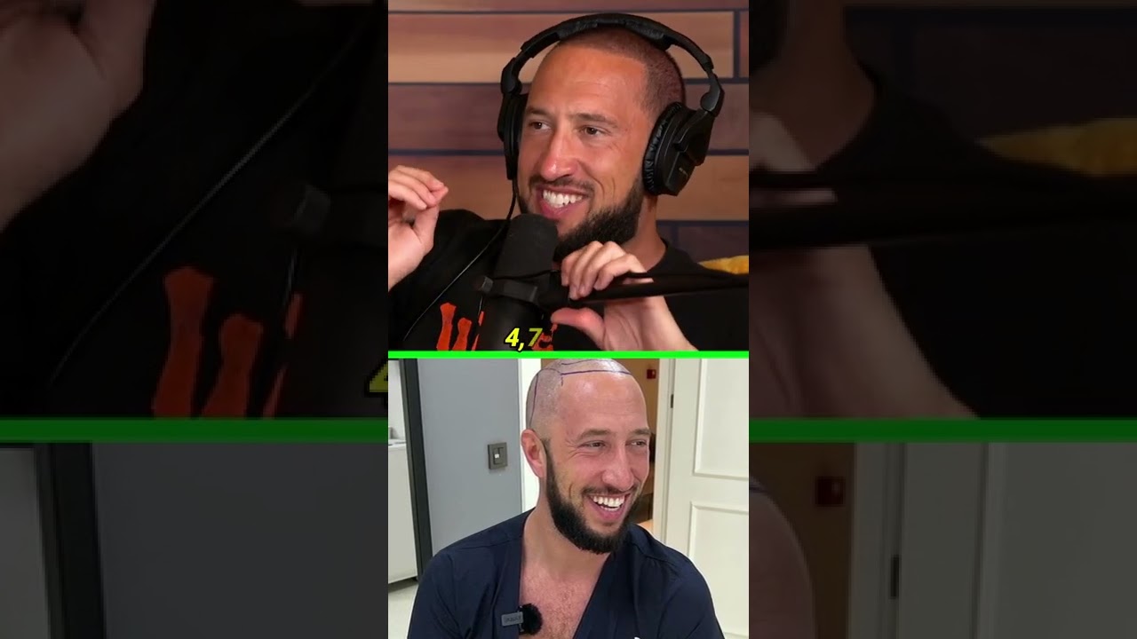 ✂️ MIKE'S HAIR TRANSPLANT #shorts