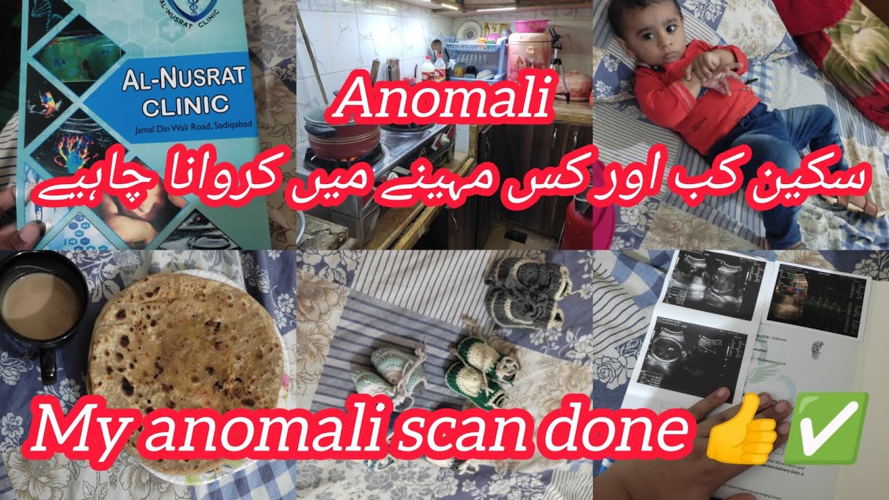 Anomali scan kis month ma krwana chaiy || Kiya anomali scan zaruri hai|| heaven vlog 2.0