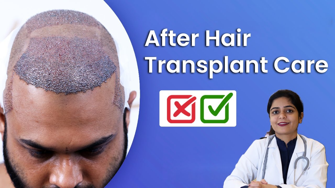 How To Take Care After Hair Transplant Surgery ?