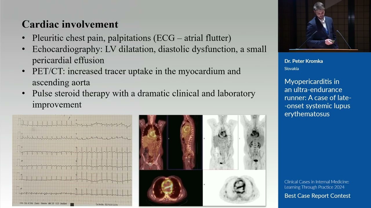 Myopericarditis in an ultra-endurance runner: A case of late-onset systemic lupus erythematosus