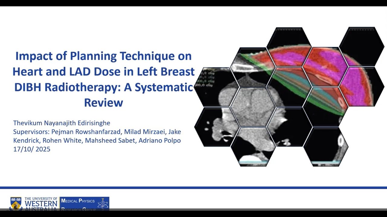 Impact of Planning Technique on Heart and LAD Dose in Left Breast DIBH Radiotherapy