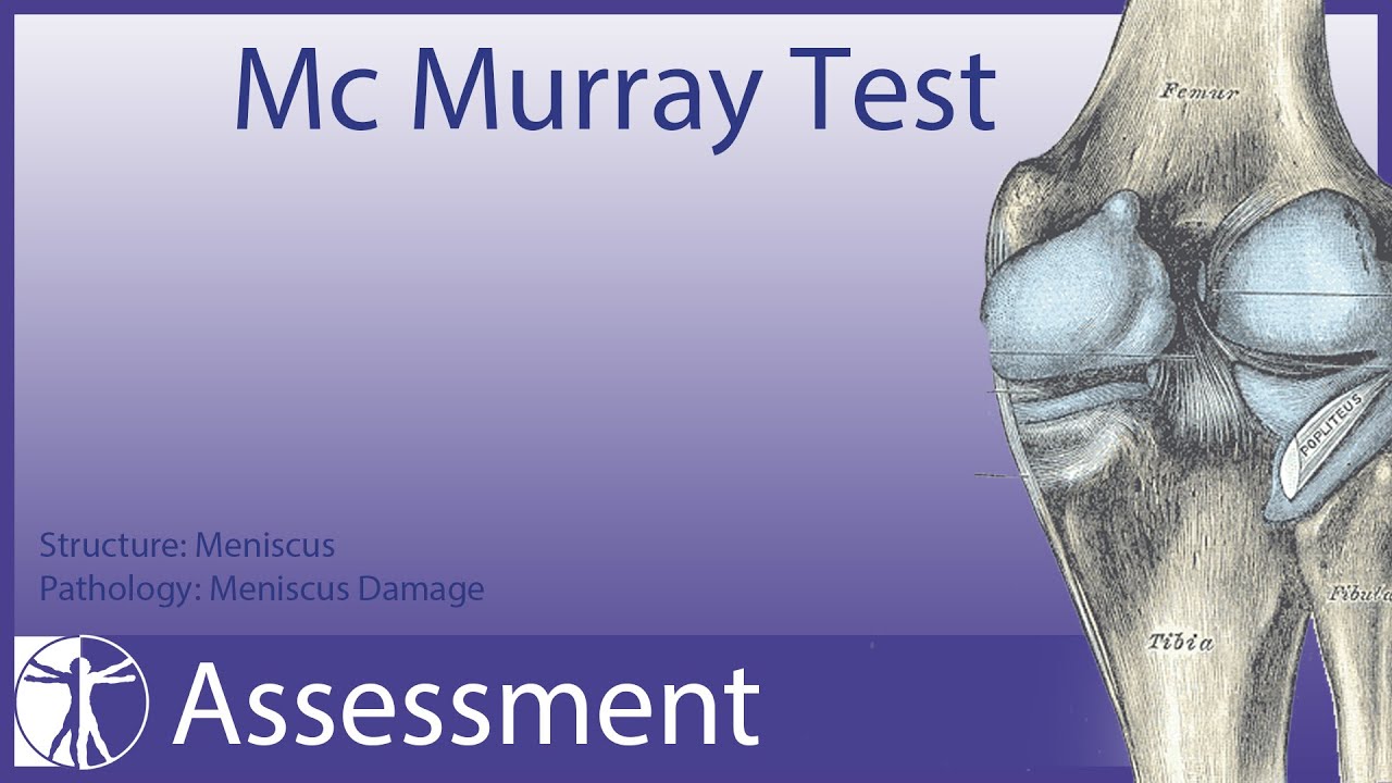 McMurray Test | Meniscus Damage (update in description)