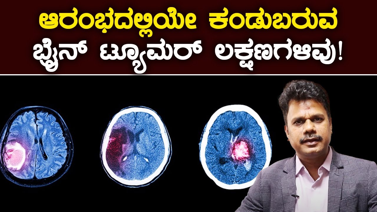 Early Signs and Symptoms of Brain Tumor | ಬ್ರೈನ್ ಟ್ಯೂಮರ್ ಲಕ್ಷಣಗಳಿವು.. ಅಸಡ್ಡೆ ಮಾಡಬೇಡಿ|Vijay Karnataka