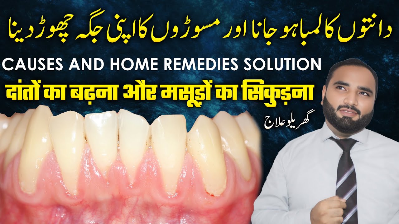 Can Gums Grow Back? | Home Remedy for Teeth Gum Recession in Urdu/Hindi | Cure Receding Gums