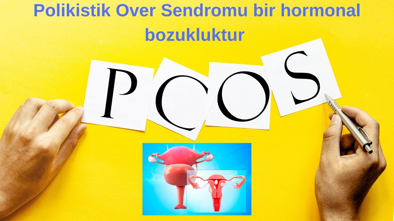 Polikistik Over Sendromu bir hormonal bozukluktur . | Dr. Alp Nuhoğlu