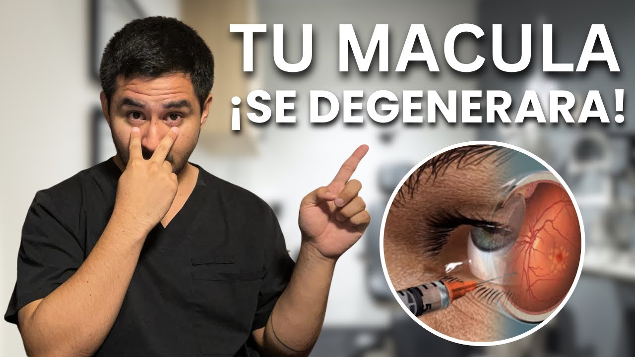 ALERTA! Por Esta Peligrosa Raz&oacute;n Se Degenera La Macula (Y COMO EVITARLO)