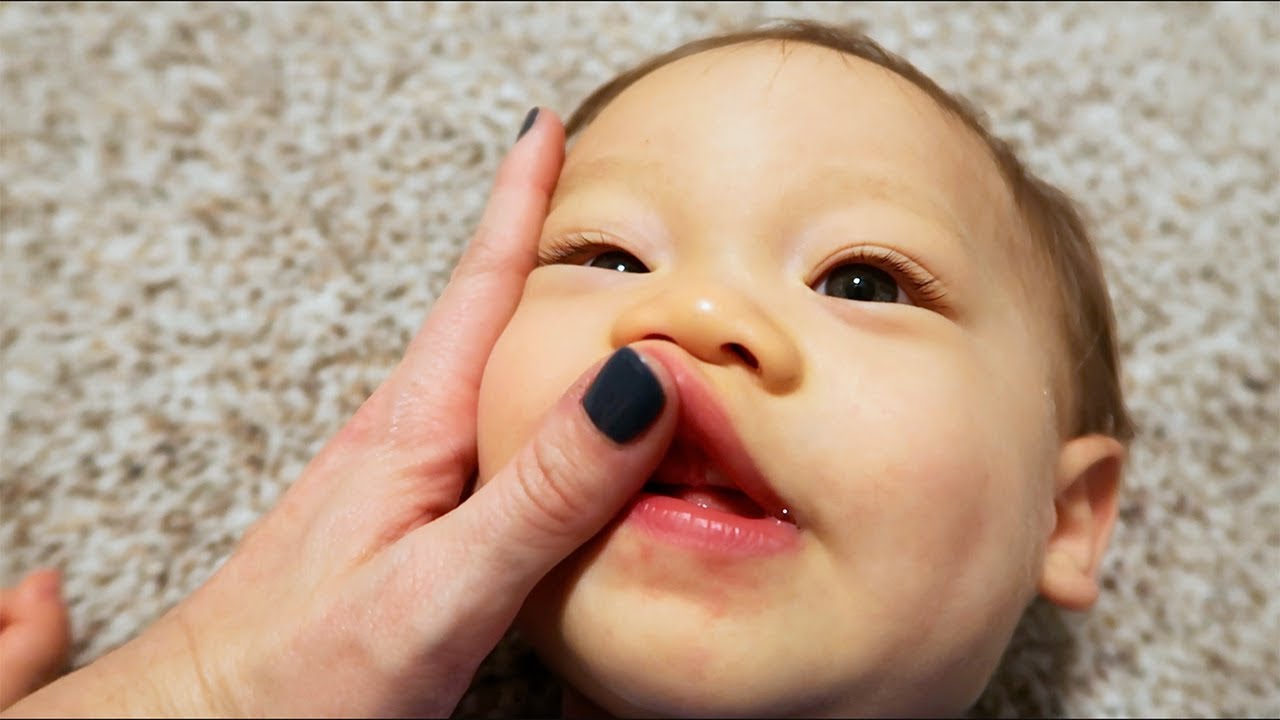 Both My Babies Were Born With This..