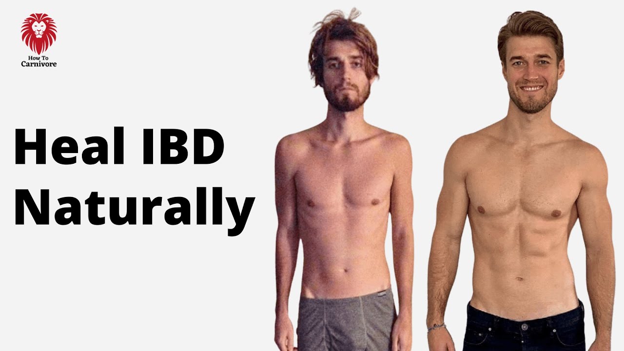 Dane Johnson: Healing Crohn&rsquo;s & Colitis Naturally &mdash; Becoming the CEO of Your Health