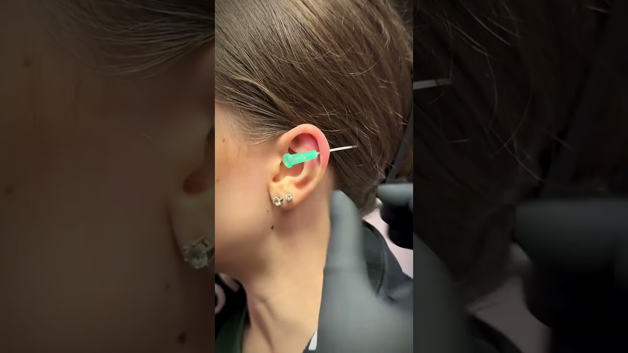This Is For You If You Want a Helix Piercing ✨ @undergroundbodypiercing  #earpiercing #piercing