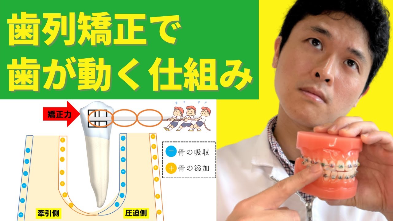 【歯列矯正で歯が動く仕組み】矯正歯科医が解説