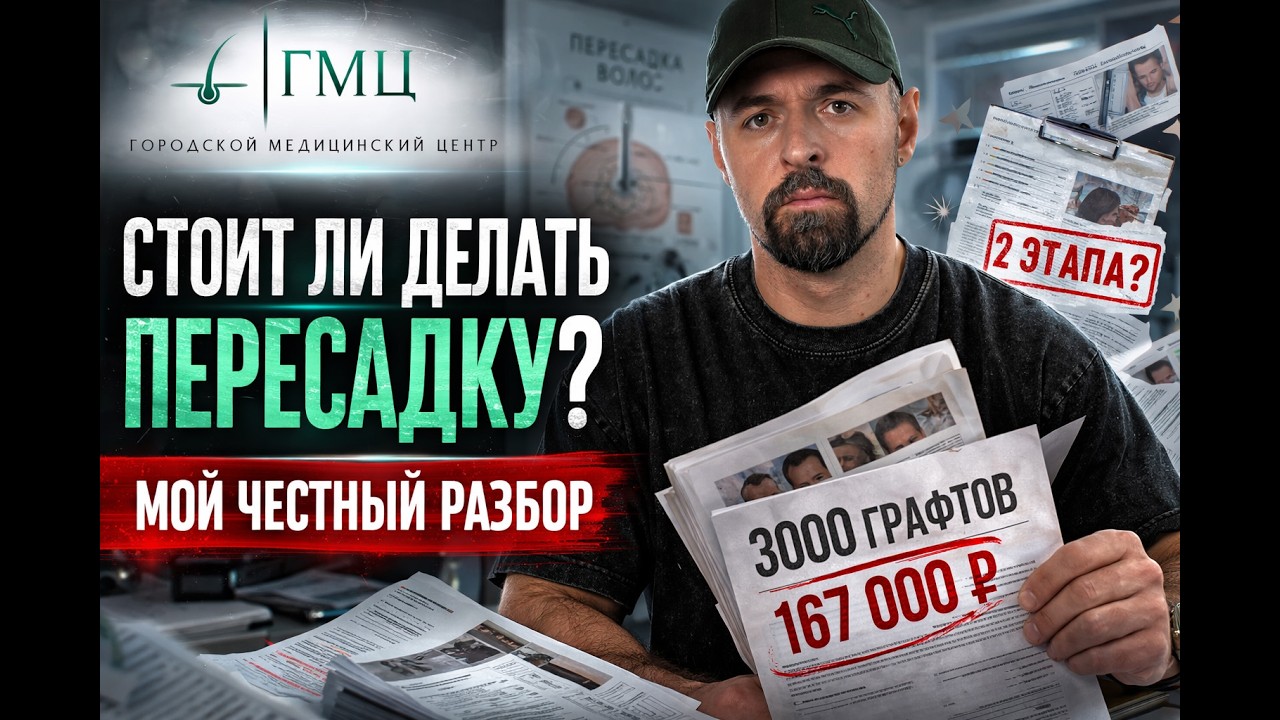 ГМЦ — стоит ли делать пересадку волос? Честный разбор клиники | Мой личный опыт