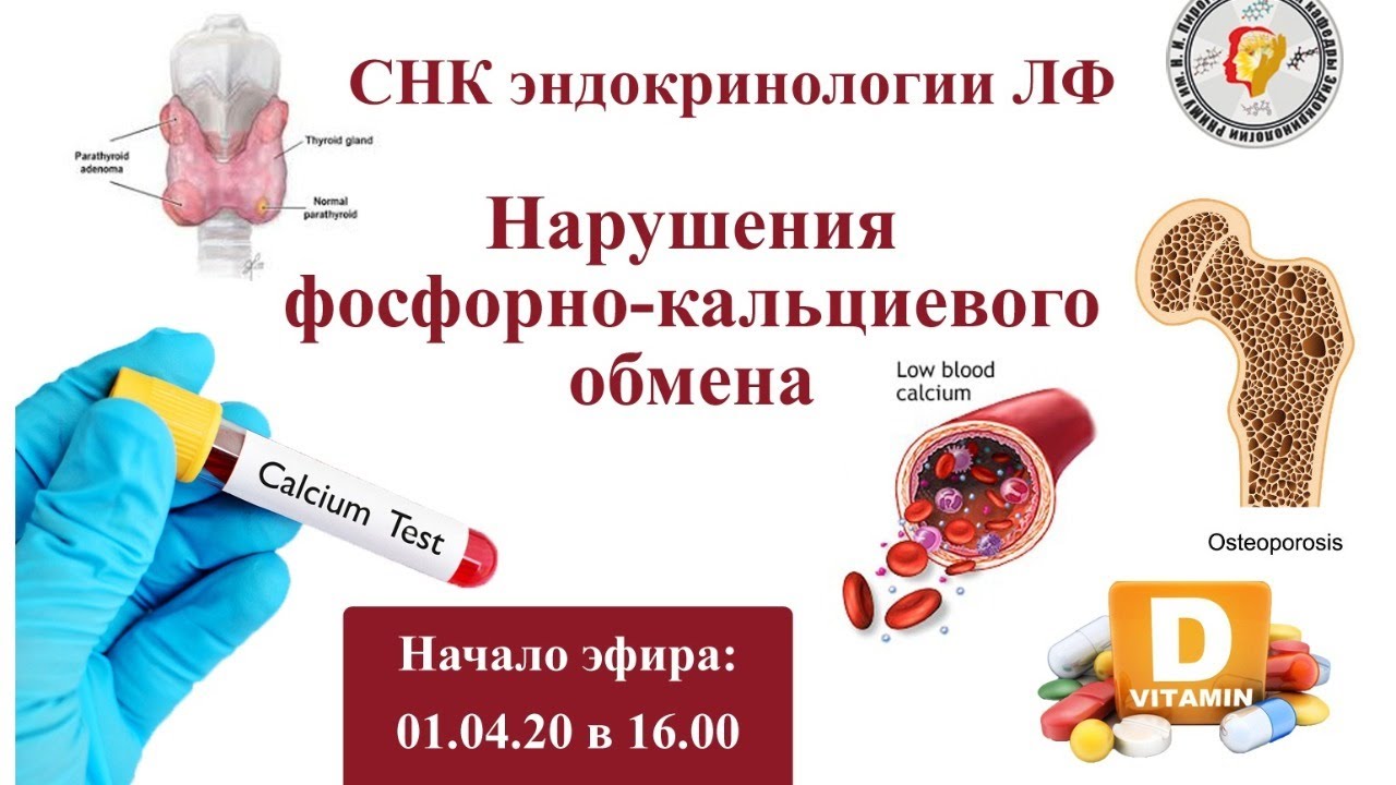 Нарушения фосфорно- кальциевого обмена