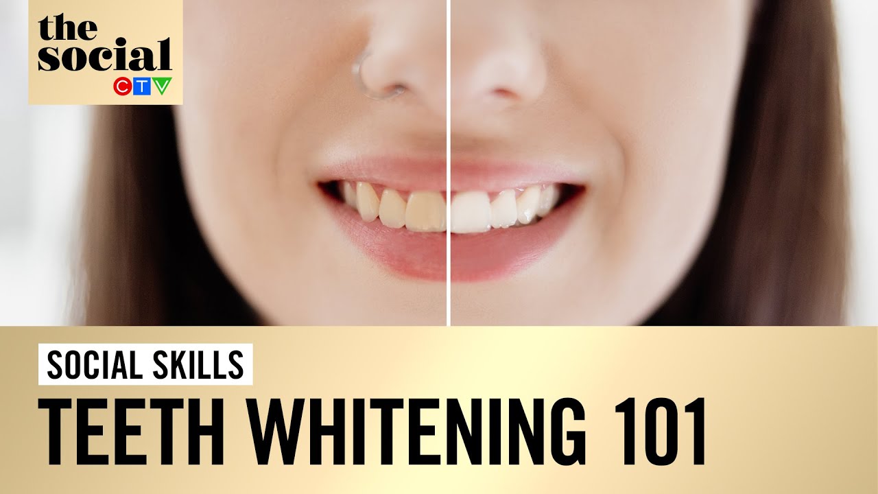 Teeth whitening 101 | The Social