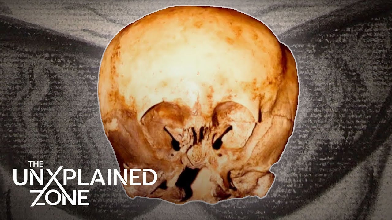 Is the Starchild Skull of Extraterrestrial Origin? | UFO Hunters | The UnXplained Zone