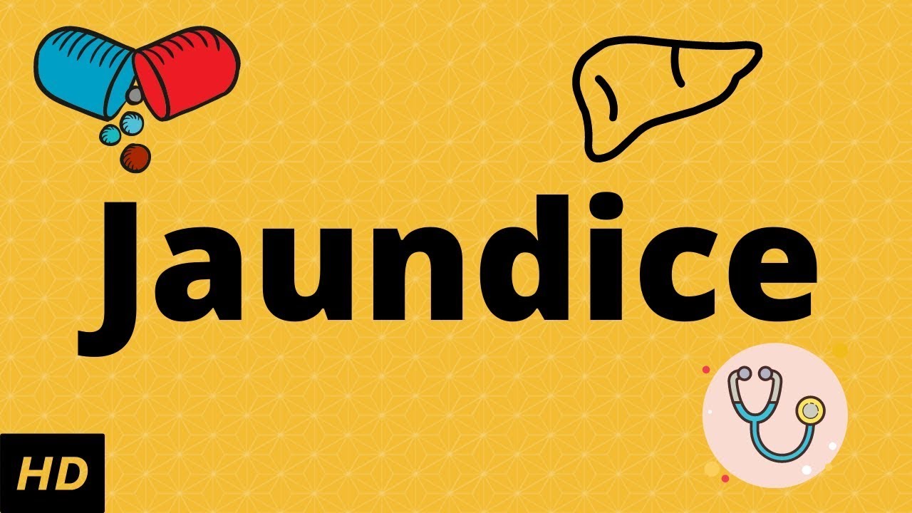 What is Jaundice?Causes, Signs and symptoms, Diagnosis and treatment
