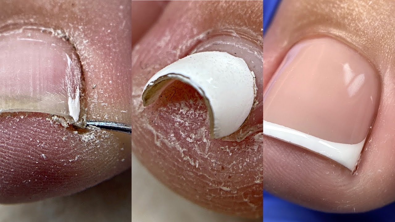 Педикюр на влажных ножках💅Френч😍Преображение ногтей😍Модный дизайн ногтей