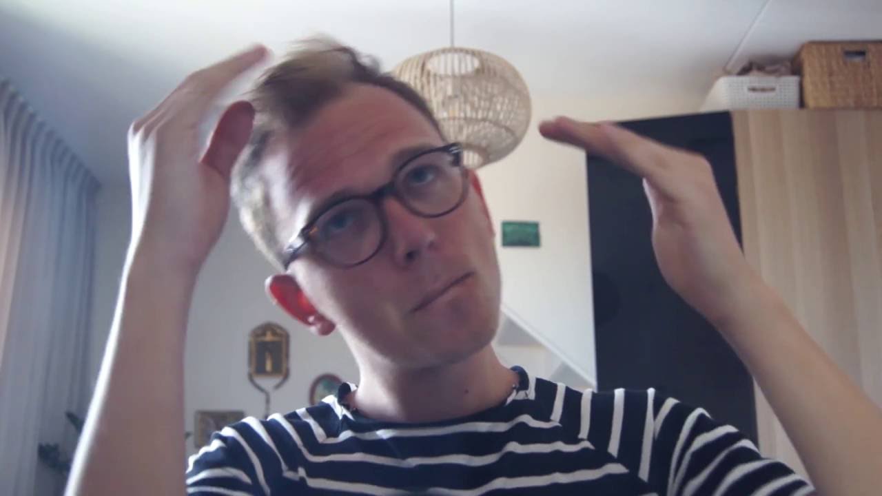 Haartransplantatie in turkije VLOG1 - Before