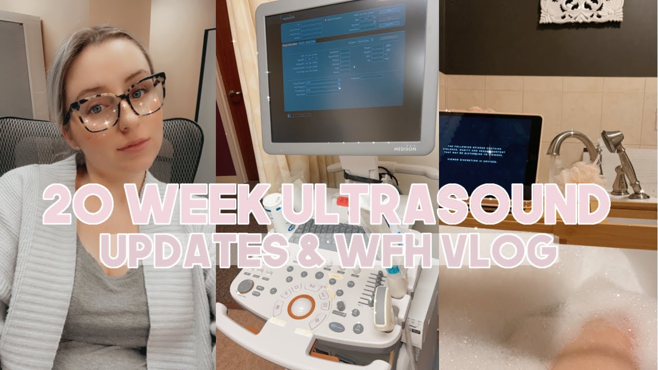 INTERN VS. ATTORNEY, 20 WEEK ULTRASOUND, WFH VLOG