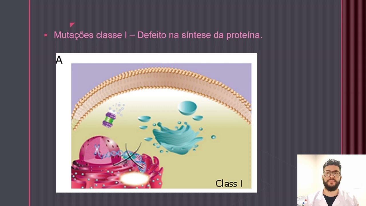 FIBROSE CÍSTICA   Felipe Rios Siqueira