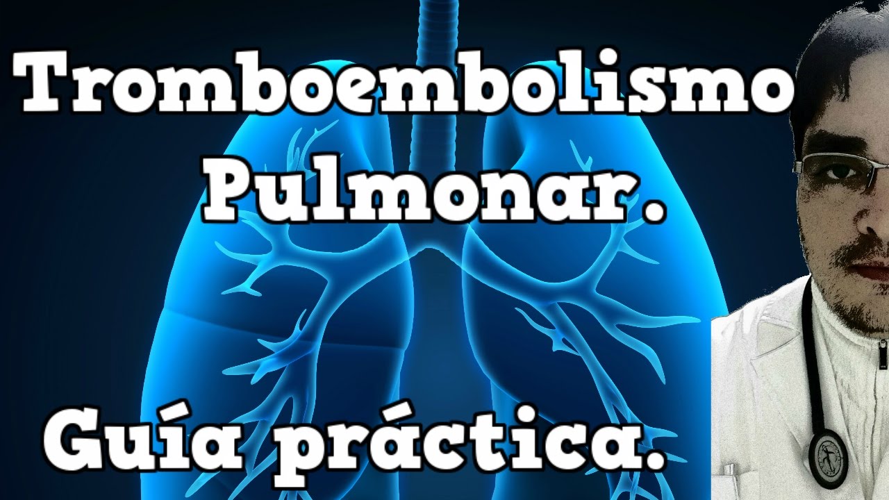【Tromboembolismo pulmonar】Guía práctica.