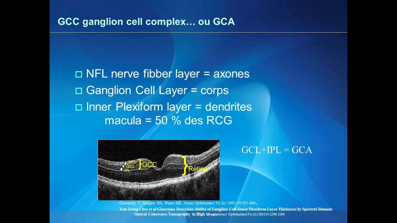 Surveillance du glaucome : Imagerie. Lachkar Y.