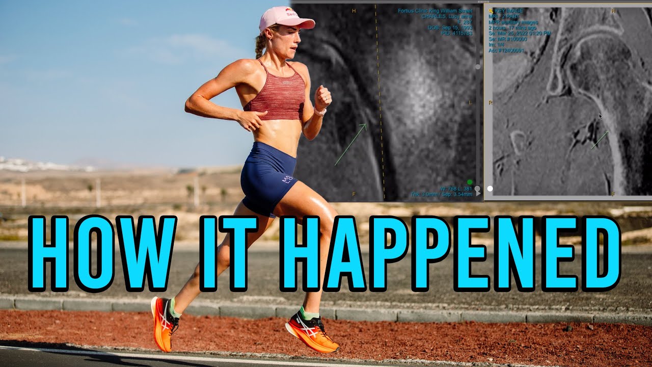 How I got Injured | Stress Fractures | Road to Recovery