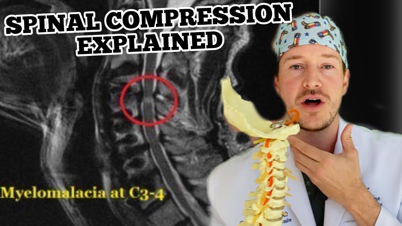 Spinal Cord Compression