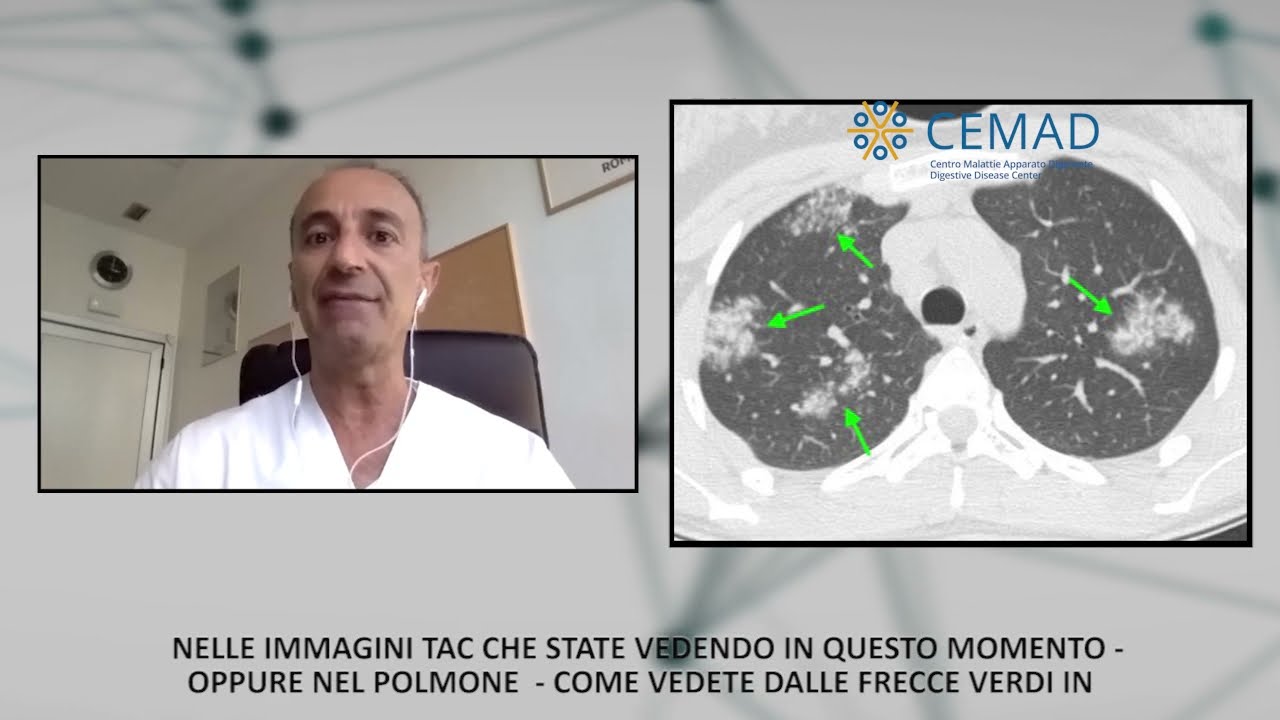 L' approccio diagnostico nella Sarcoidosi