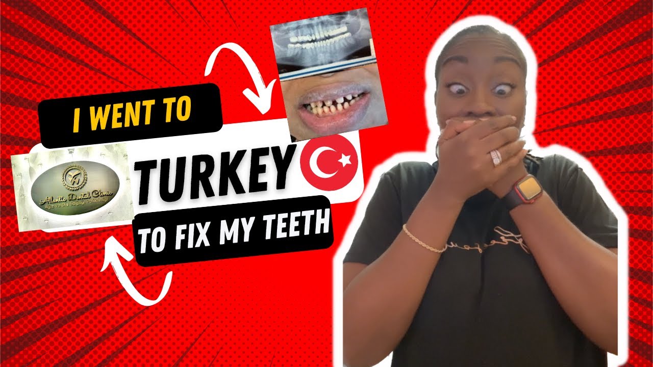 WATCH THIS BEFORE you go to Turkey to fix your teeth| Dr. Ebru|Atlantic Dental| What I wish I knew!